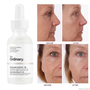 The Ordinary™ (KIT Premium)